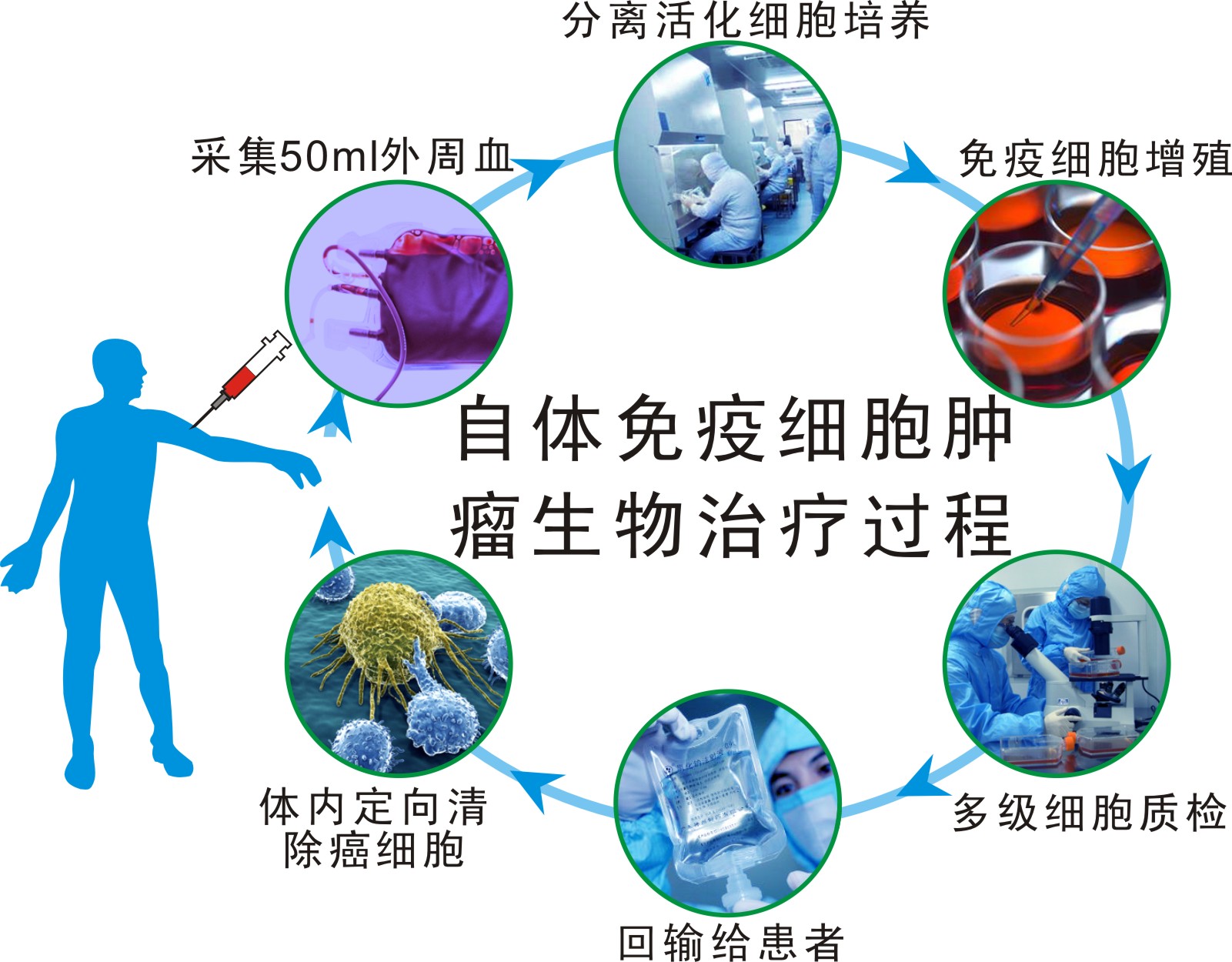 自体免疫细胞体系肿瘤生物治疗全 过程